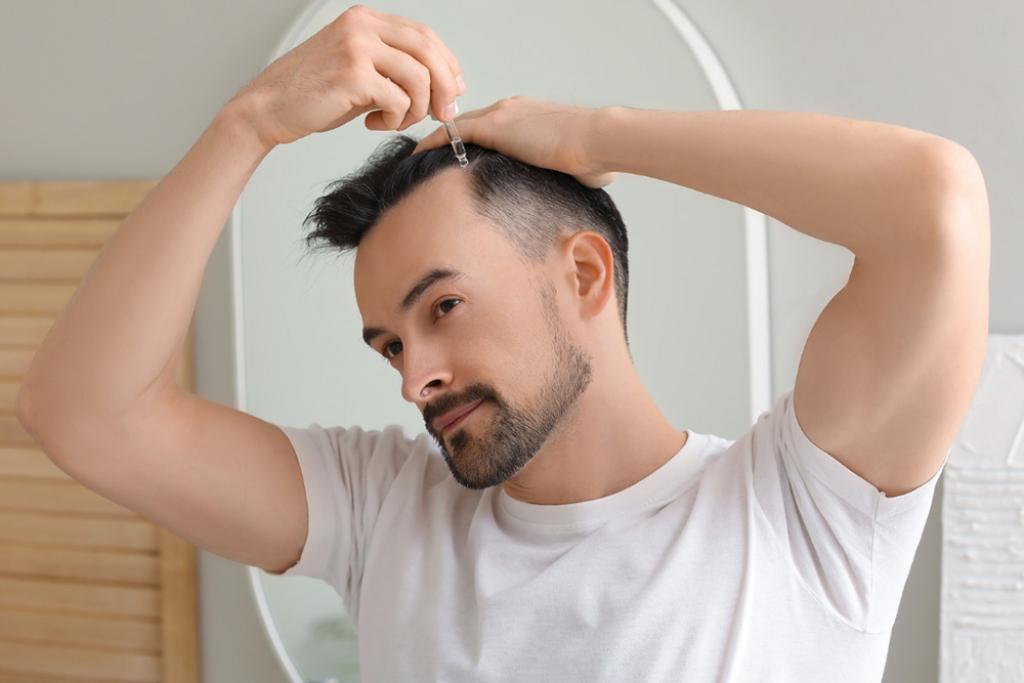 HAIR LOSS SOLUTIONS: NATURAL ALTERNATIVES TO MINOXIDIL