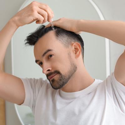HAIR LOSS SOLUTIONS: NATURAL ALTERNATIVES TO MINOXIDIL